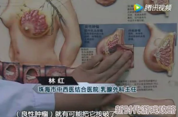 美女被揉胸视频科学家发现新型乳腺按摩疗法效果显著