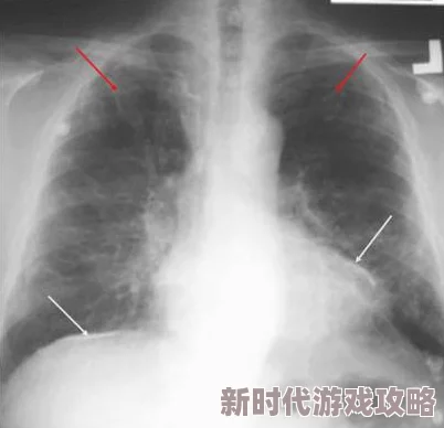 亲胸揉胸膜下刺激娇喘的录制完成进入后期剪辑预计下周发布