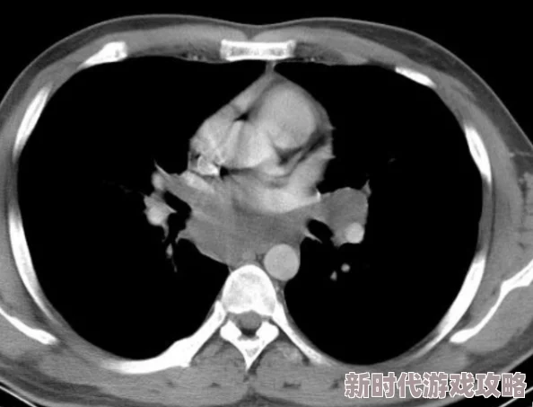 见缝插针如何防止留疤 | 有效预防疤痕的方法解析 见缝插针如何防止留疤 | 有效预防疤痕的方法解析